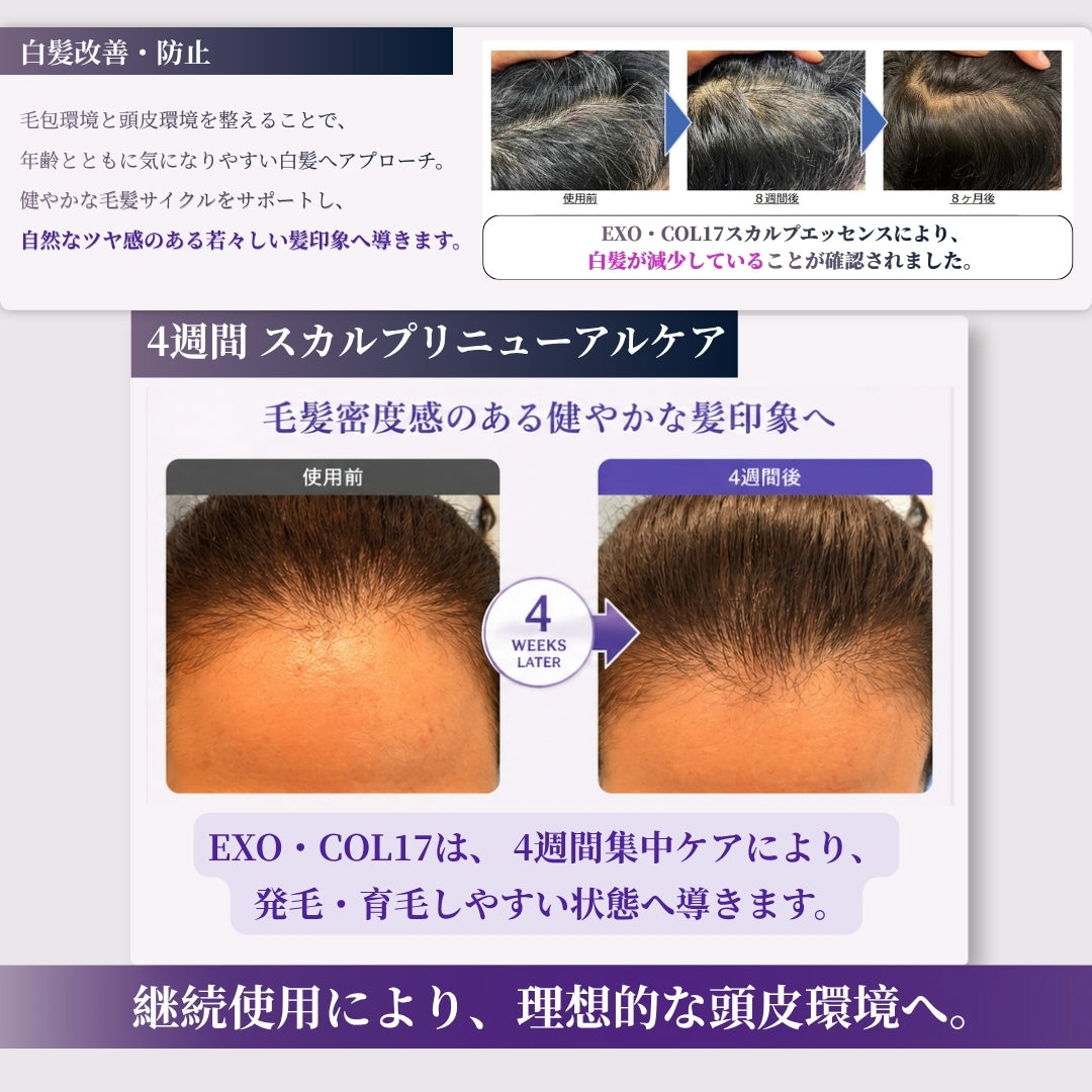 ONSENSOU RE:LAB EXOSOME | EXO•COL17 Scalp Essence