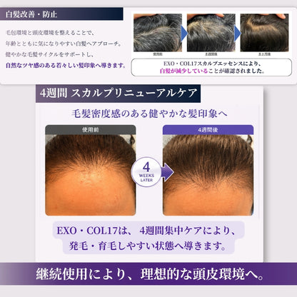 ONSENSOU RE:LAB EXOSOME | EXO•COL17 Scalp Essence